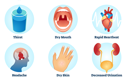 Dehydration sysmptpms